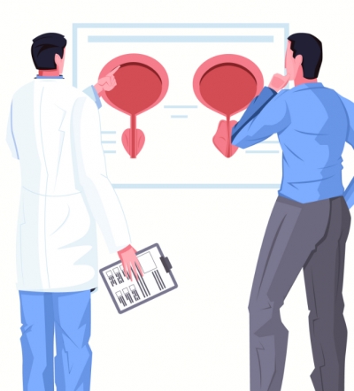 OLIGOMETASTATIC PROSTATE CANCER